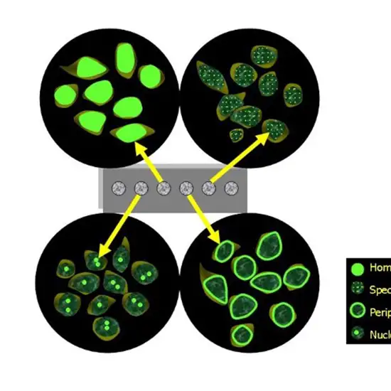 extractable nuclear antigen quantitative antibodies